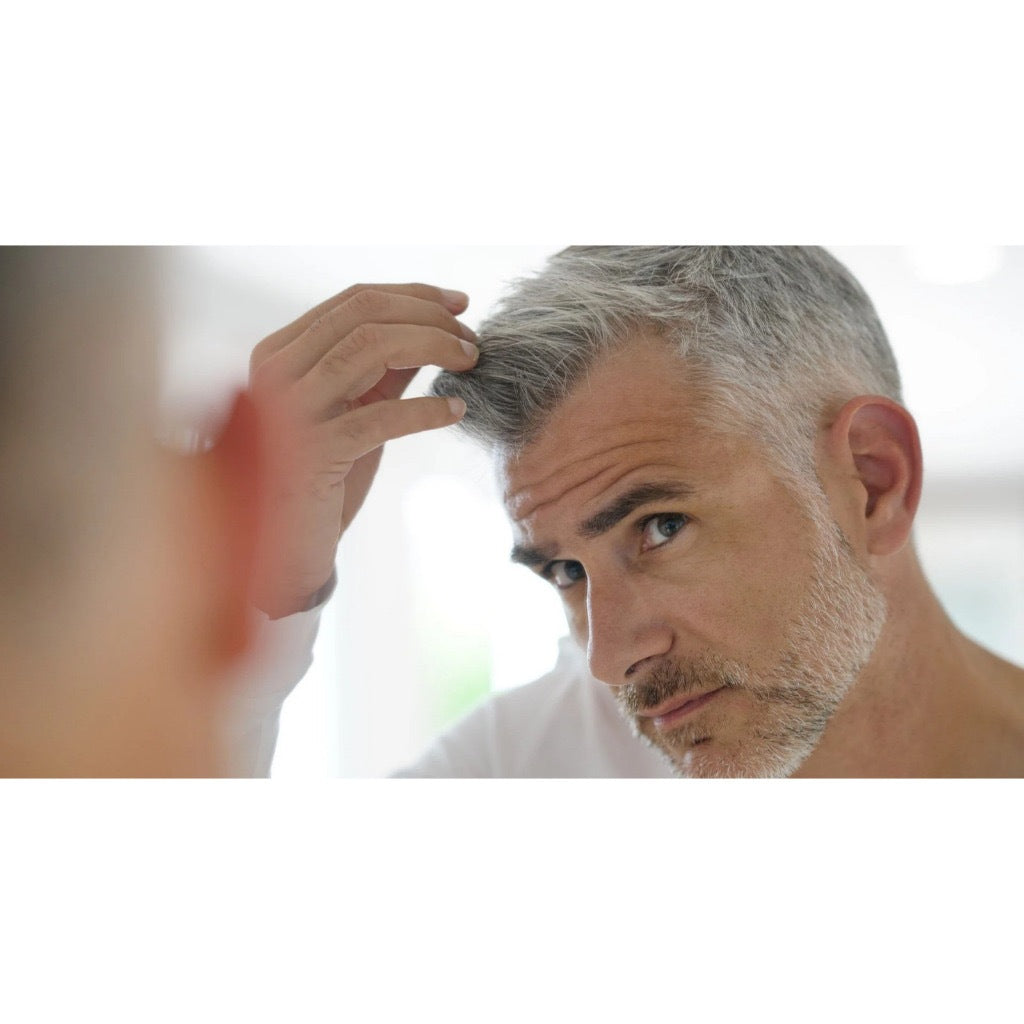 Shampoo Matizador Platinum Classe A 300ml Para Grisalhos E Loiros Desamarelador 12un